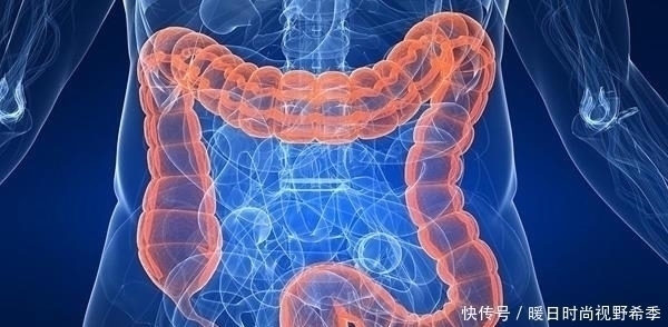 癌症|患直肠癌前,身体可能发出这4种“求救信号”,别犹豫及时就医