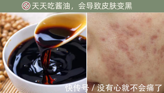 酱油 天天吃酱油,会导致皮肤变黑吗?美白护肤有哪些误区?