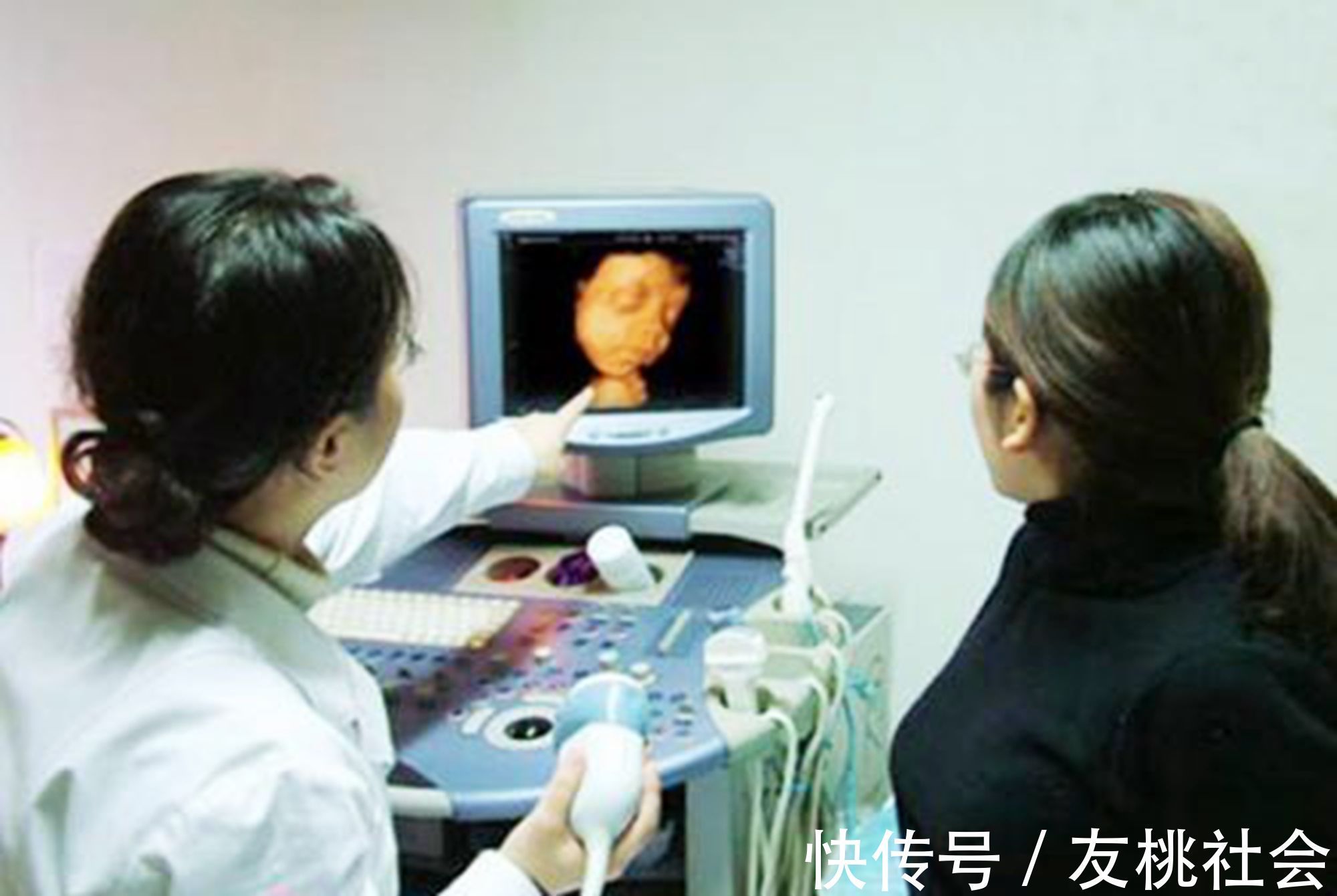 孕妈|产检做四维彩超,为什么“家属勿入”?其实是出于“三保护”原则