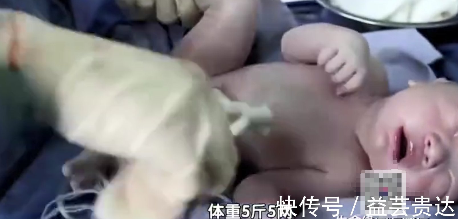 宫缩|助产士生娃:痛得咬老公,同事准备产钳助产,差点顺产转剖宫产