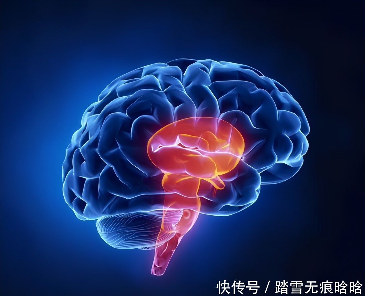 50岁以后,出现4个症状,可能脑梗要发生,提高警惕