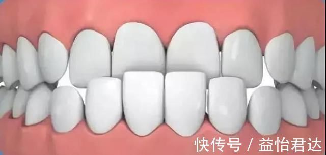 不良习惯|孩子12岁前必须处理的牙齿问题!家长都了解吗?