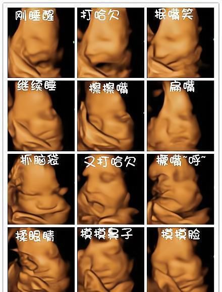 体表|为何有的医院做四维彩超不让家属陪?这3大原因,孕妇有权知道