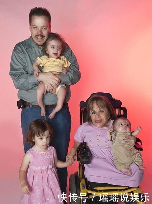 斯塔赛|身高仅71厘米的“瓷娃娃”,不顾医生劝阻连生3孩子,后来怎样了