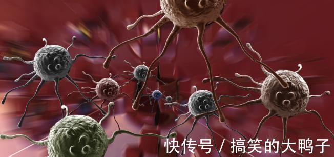 癌症|治疗癌症采用放疗很常见,关于5个副作用要牢记,早知道早作准备