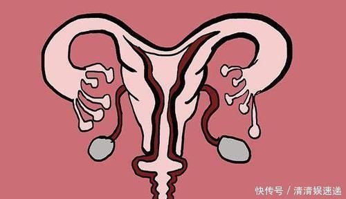 奶茶|女性纵容的几个随意行为，让子宫很受伤，请你学会爱自己