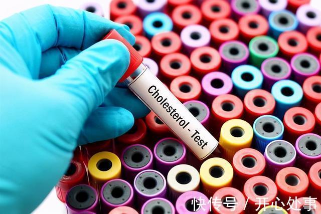 体检|医院体检时，血常规检查单上这几个指标很重要，你了解吗？