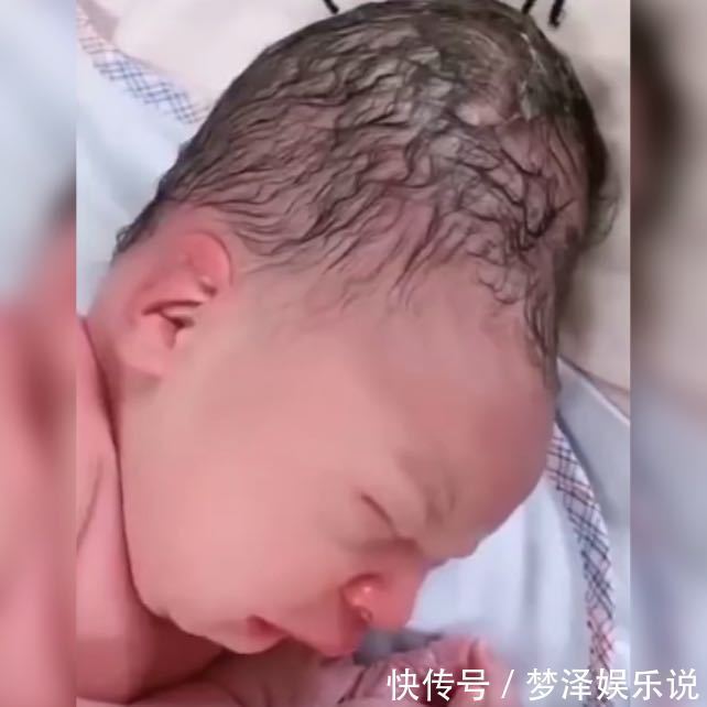 头骨|产妇分娩时不懂正确用力,婴儿头部被严重挤压,网友:很像寿星公