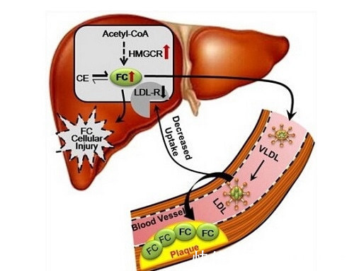升高|转氨酶升高，就是得了肝炎手把手教你看懂肝功能体检报告单