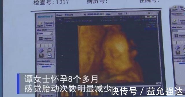 胎心|怀孕38周胎死腹中,孕期胎儿三种“求救”信号,孕妈快接收早营救