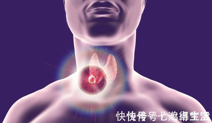 樱桃|甲状腺结节患者能吃豆腐吗?医生:不碰这3种食物,结节或会好转