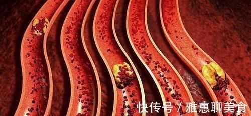 血糖升高|糖尿病患者吃晚餐时，要遵守5大原则，做到了，或能避免血糖飙升