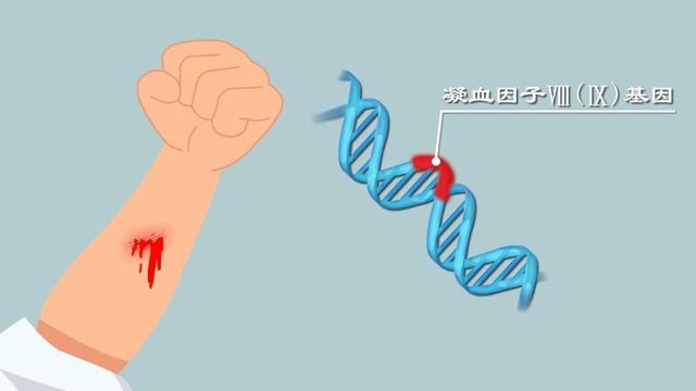 基因|夫妻正常却生出“玻璃娃”？血友病与基因啥关系？婚检产检咋筛查