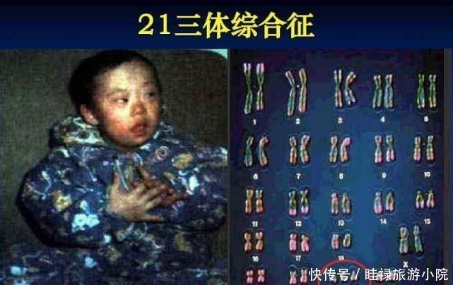 医生|孕期产检不想生个“傻孩子”，这三项产检必须按时做，不能忽视