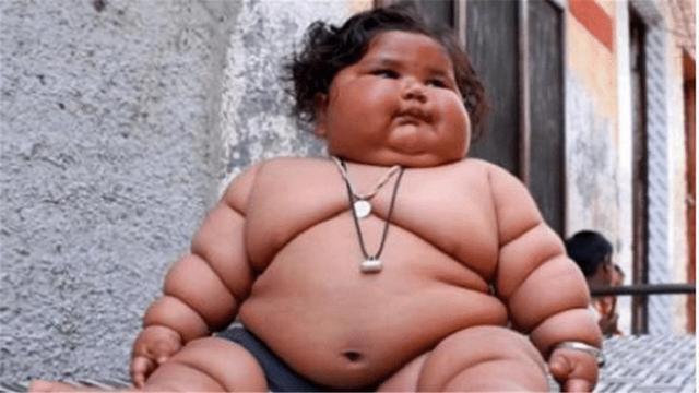 孩子|那个1岁体重高达45斤的孩子,太能吃父母担心养不起,如今怎样了