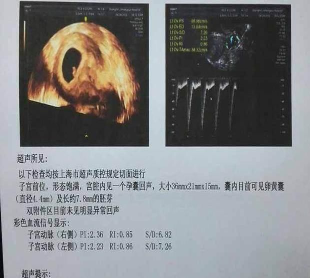 月经周期|胎心胎芽出现的时间,为何有早有晚?这3个原因很说明问题