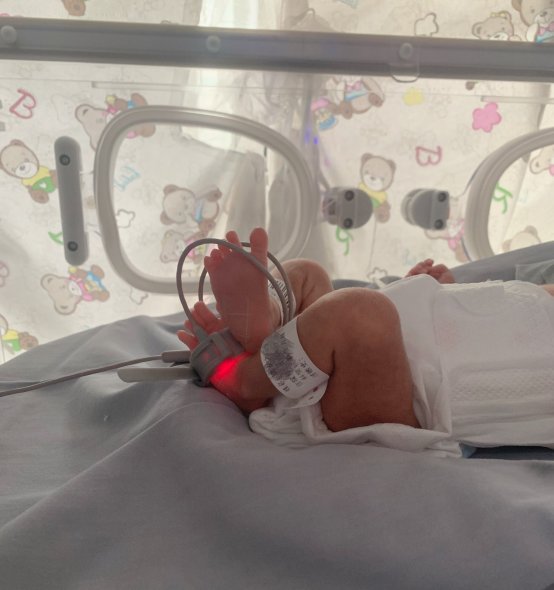 新生儿科|三胞胎早产儿宝宝，济南市中心医院新生儿科保驾护航