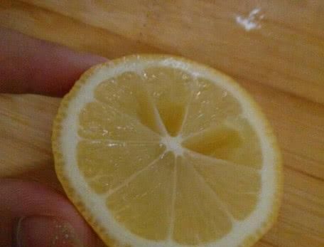 女人有没有妇科病，这3个“地方”一看便知，00后也别害羞