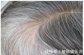 化妆品安全技术规范 中年人经常染发,真会致癌吗?专家提出4点小建议,做到放心染