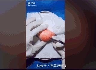 王醫生|32歲醫生竟給水果做手術？一夜吸粉12萬！網友：“我的膝蓋跪爛了”