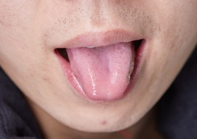 血瘀|病从血瘀生，十女有九淤！三个宝贝活血化瘀，美容养颜，值得一试