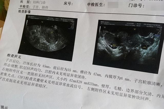 迟缓|6个月宝宝智力迟缓，只因宝妈在怀孕期间，忽略了这一项检查