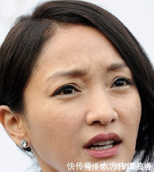 提亮|女孩子的皮肤想要变美变白,值得注意的三大要素