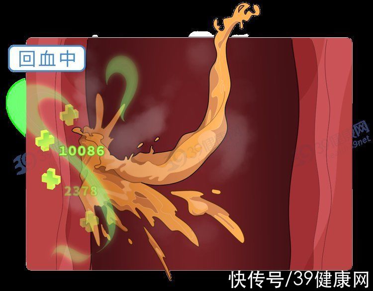 胃黏膜|“吃出来”的食道癌，为何全球一半患者在中国？3类人要重点关注
