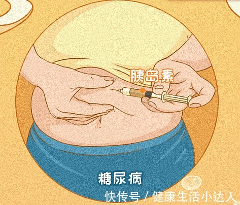 调理|糖尿病是怎么来的?常有7个感受,是血糖超标了,尽早调理