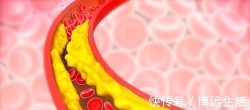 维c|血脂一降，百病消！日常多吃这6种食物，轻轻松松降血脂