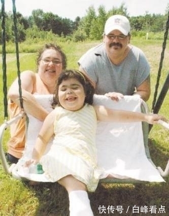 希洛|现实美人鱼女孩:没有双腿长了“人鱼尾”,却从未停止摇摆尾巴