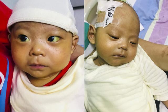 重症|漂亮孕妈得知身患重症仍冒死产子，孩子出生后老公懵了先救谁