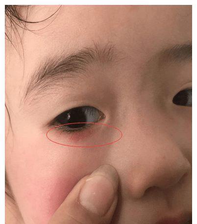 西瓜|3种水果被誉为“烂脾胃王”,孩子常吃?或许脾胃“破烂有洞”