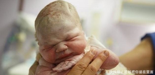 妈妈|剖腹产生宝宝时要让产妇亲吻宝宝?别小看这个环节,有这四个意义