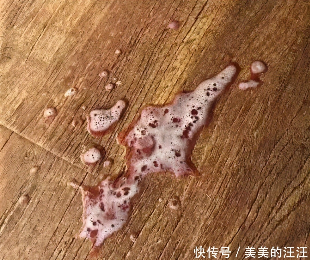 猫咪喝水后抽着呕吐