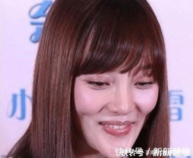 私人订制|被玻尿酸毁掉的女星,容貌前后变化太大,一般人根本认不出!