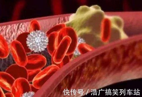 膳食纤维|建议中老年，若不缺钱多吃这2物，稳血脂通血管，还不贵