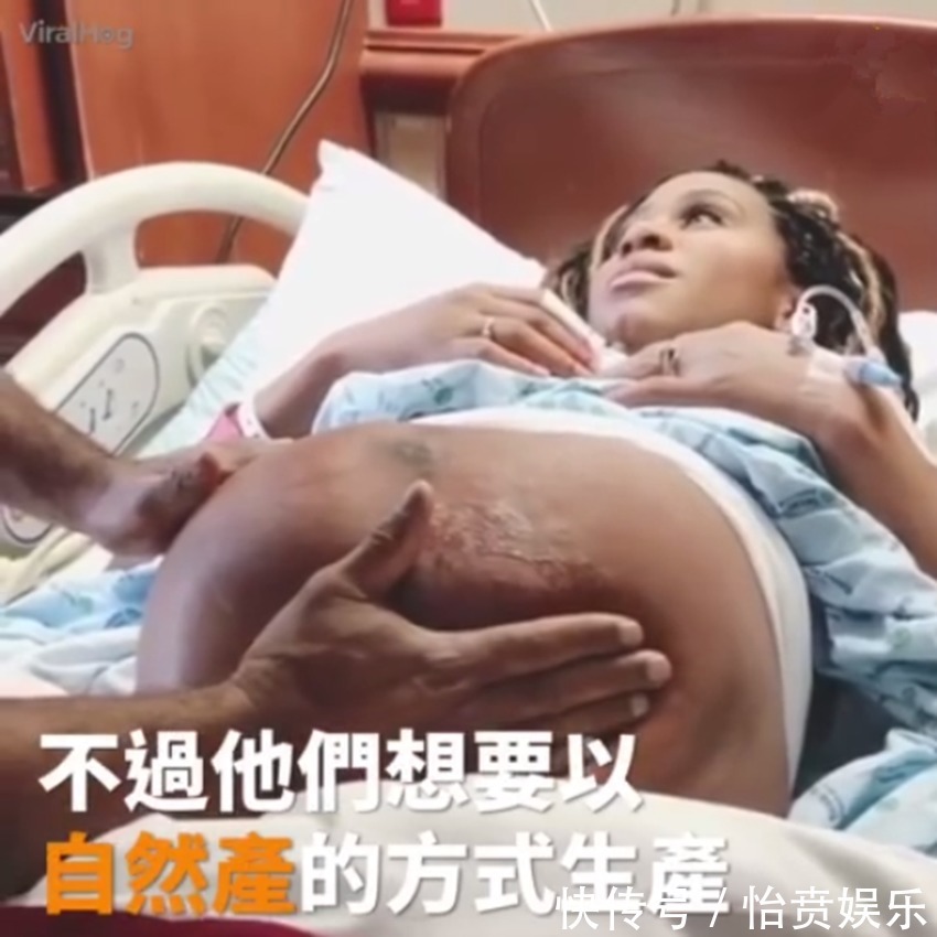 枕前位|医生徒手帮孕妈转胎位,当妈真的不容易,网友这肚皮都薄成纸了