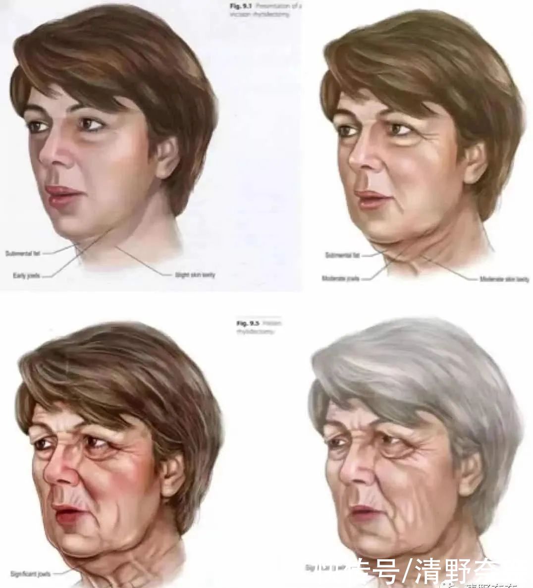 明星都躲不过！不想老太快，必吃的冻龄食物还不搞起来？