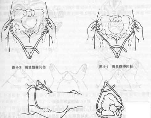 凶险性|分娩时,出现以下8种情况的产妇务必选择剖腹产,千万别犹豫误事