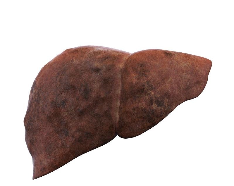 食物|肝癌是吃出来的,不想得肝癌,3种食物能不碰就不碰,了解一下