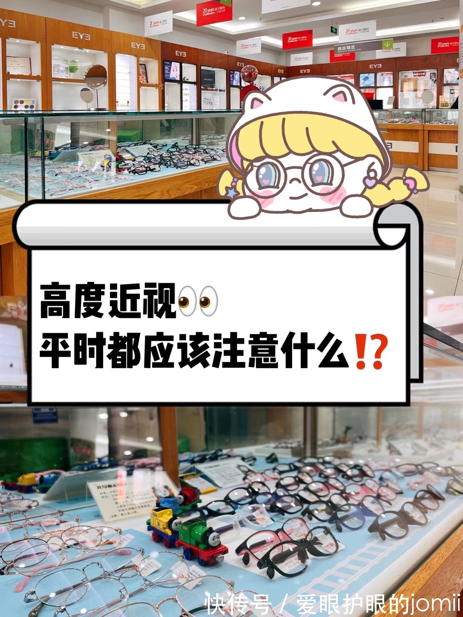 视网膜脱离|高度近视者应该注意什么