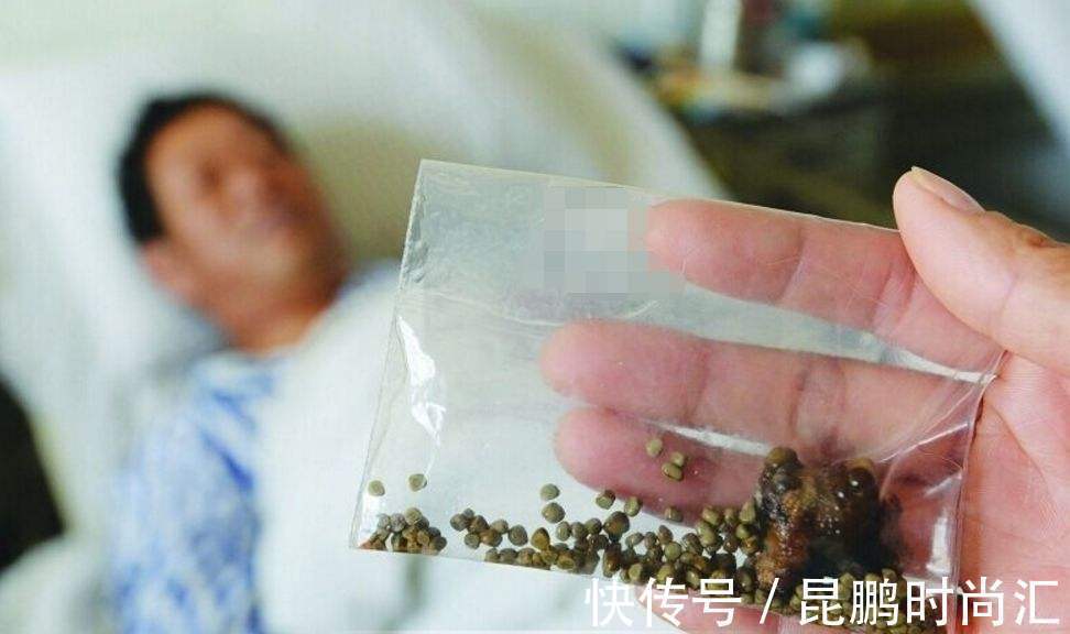 老刘|鸡身上一个宝贝，消积食、化结石，老中医眼中的“金不换”！