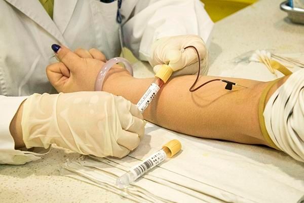 女性|HPV筛查应该怎么做？是抽血吗？女性应该了解妇科检查常识