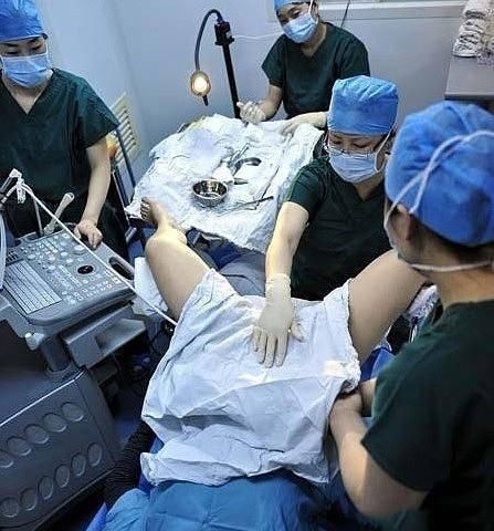 胚胎|揭秘试管婴儿全过程(附图)，看完后心疼女性一万遍