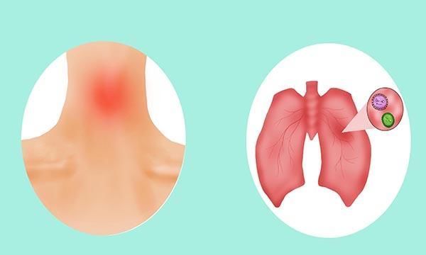 肺部问题,生活小细节你不容忽视,如果症状开始出现,得尽早就医