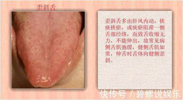 症候群|人只要一直活着,早晚会患上痴呆!是这样吗