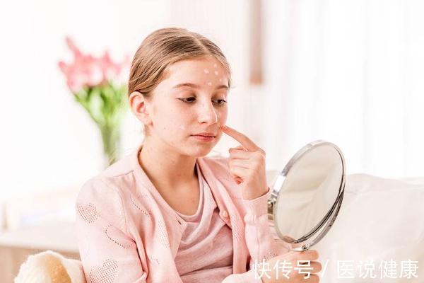 治疗|医生指出:得了荨麻疹,做好这5件事,或许可以帮你缓解症状