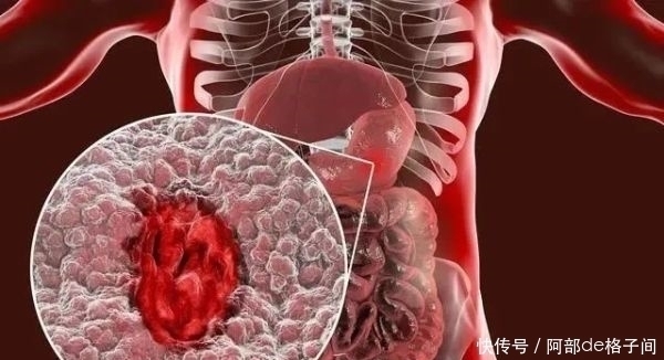 跑步|坚持跑步的好处有哪些?科学跑步,要注意什么?现在就逐个分析