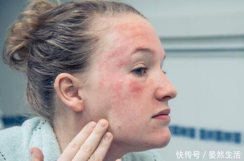 去角质|让皮肤变差的3种护肤方式,真的,你还不如只用清水洗脸